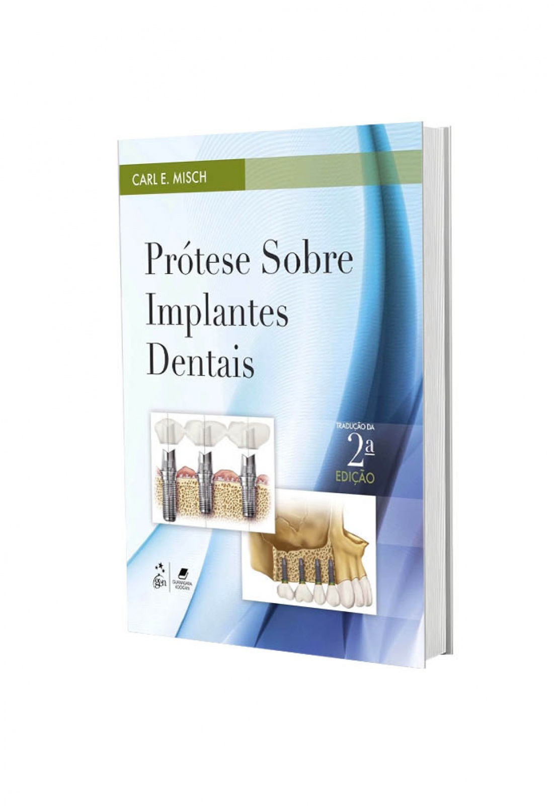 Prótese Sobre Implantes Dentais