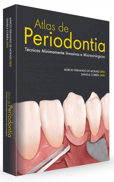 Atlas De Periodontia