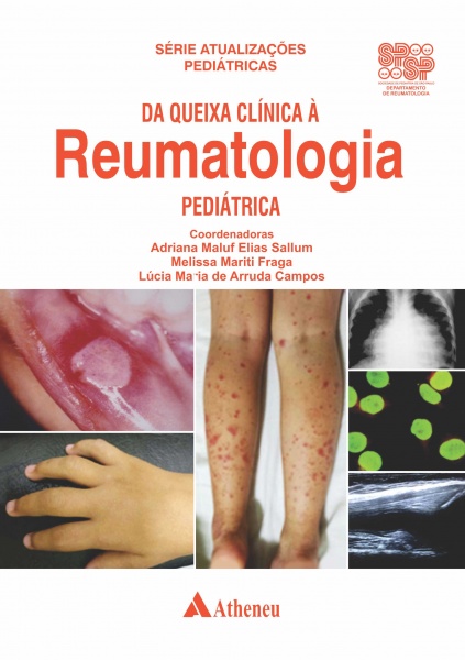 Da Queixa Clínica À Reumatologia Pediátrica