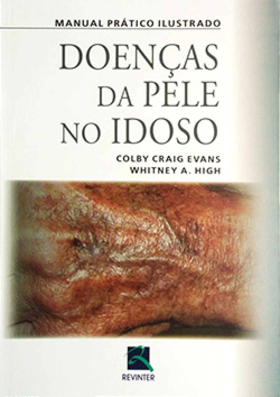 Manual Prático Ilustrado Doenças Da Pele No Idoso