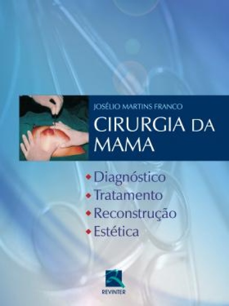 Cirurgia Da Mama Diagnóstico Tratamento Reconstrução E Estética