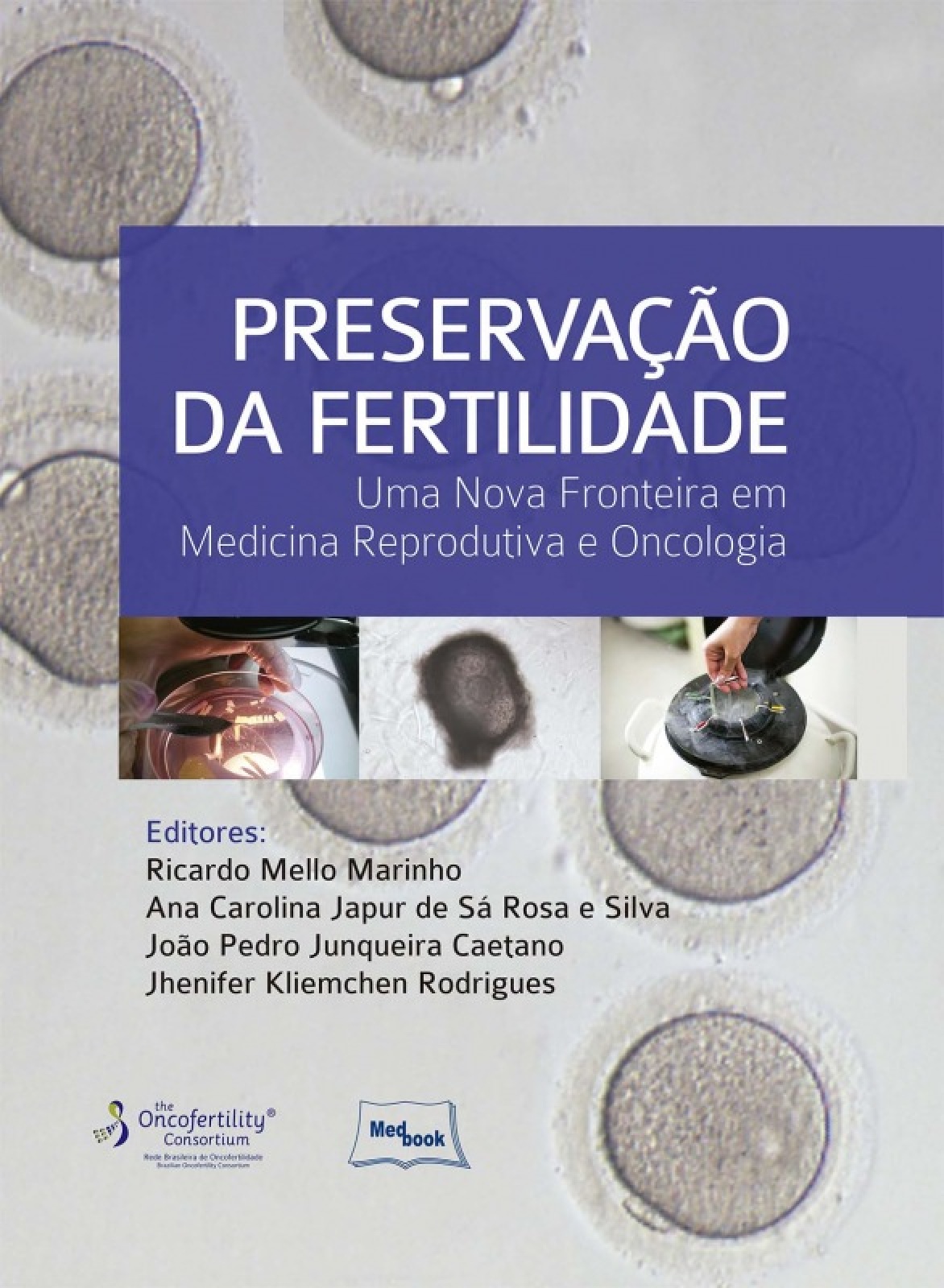 Preservação Da Fertilidade