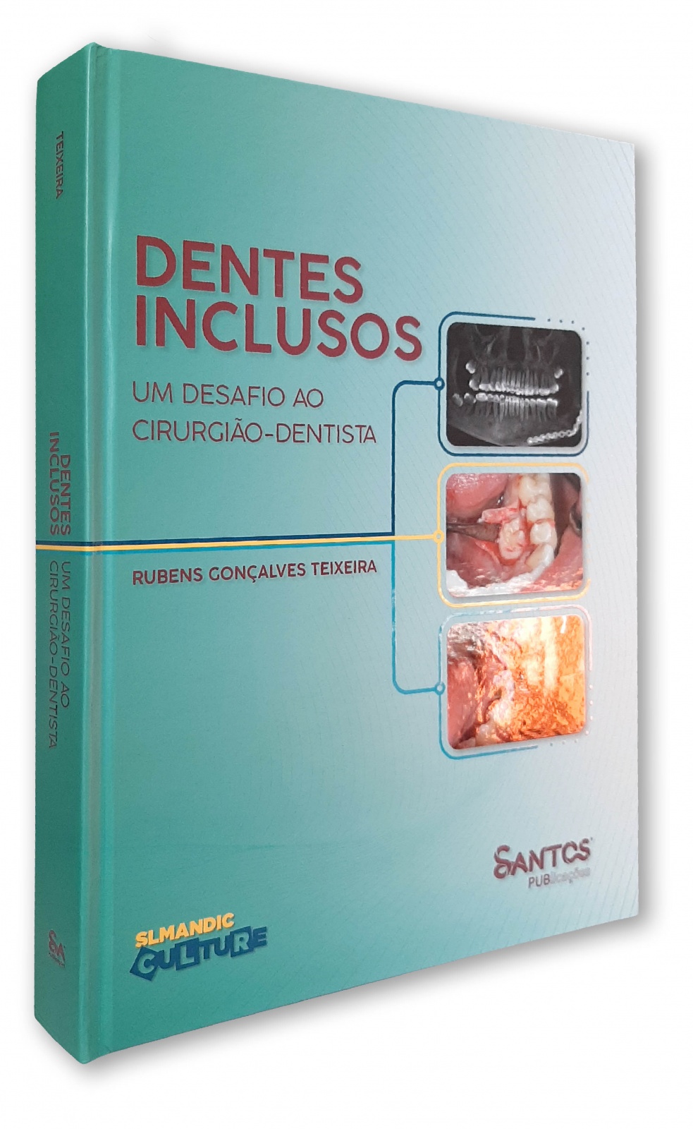 Dentes Inclusos - Um Desafio Ao Cirurgião Dentista