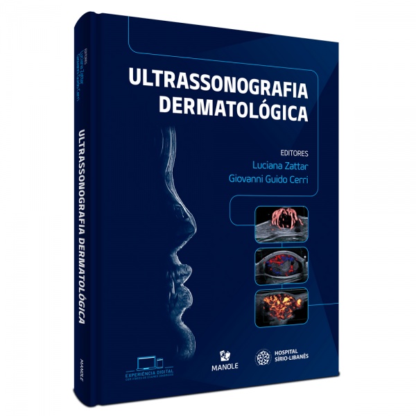  Ultrassonografia Dermatológica 