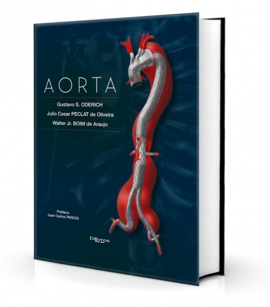 Aorta