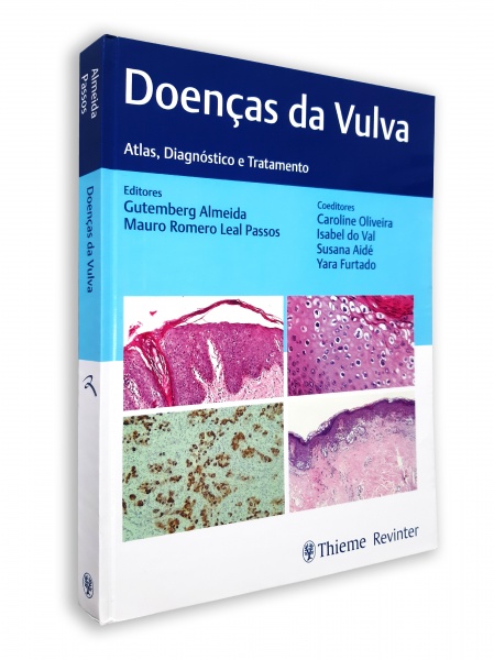 Doenças Da Vulva - Atlas, Diagnóstico E Tratamento