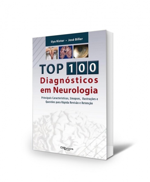 Top 100 Diagnostico Em Neurologia