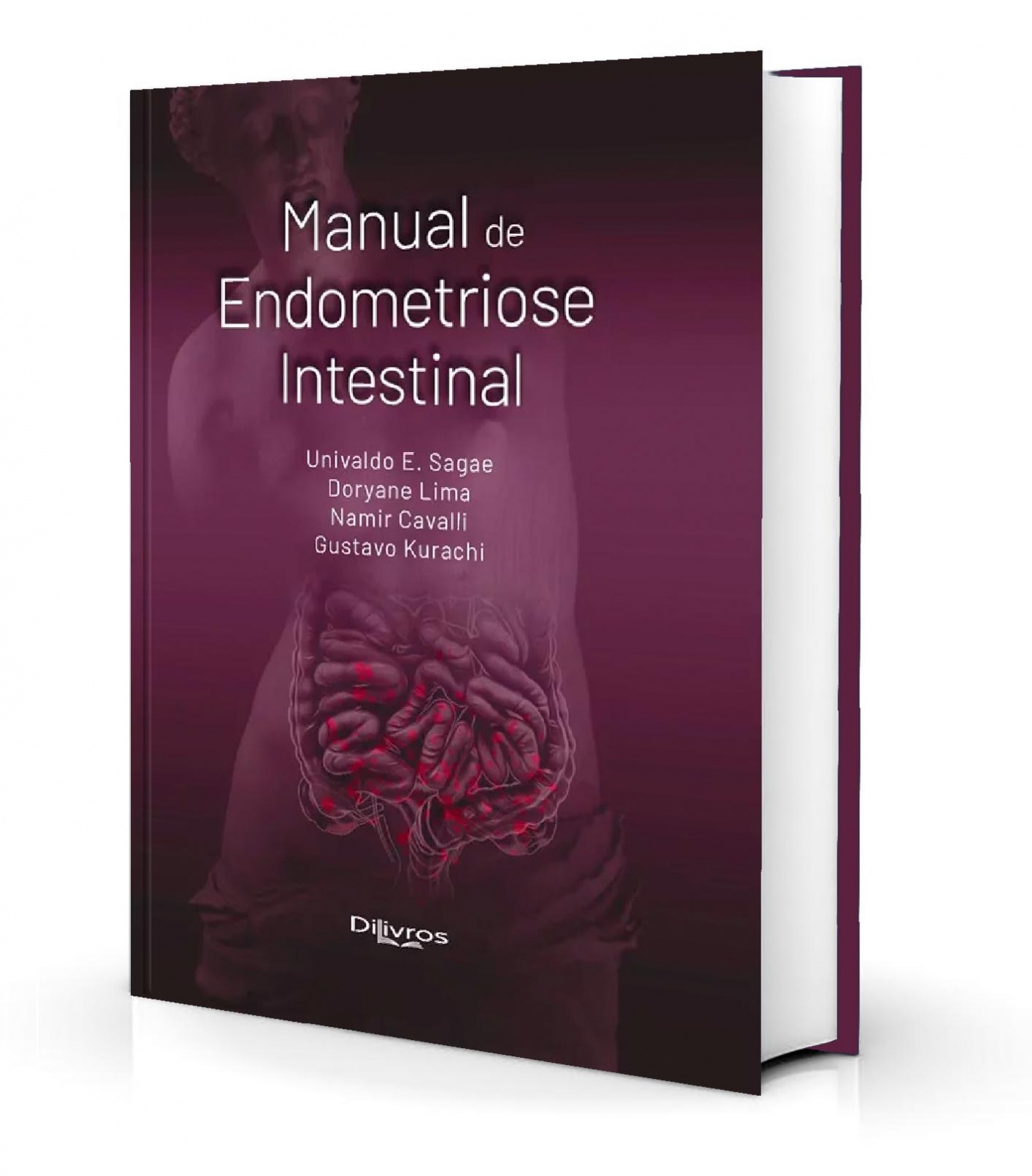 Manual De Endometriose Intestinal