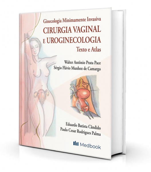 Ginecologia Minimamente Invasiva - Cirurgia Vaginal E Uroginecologia