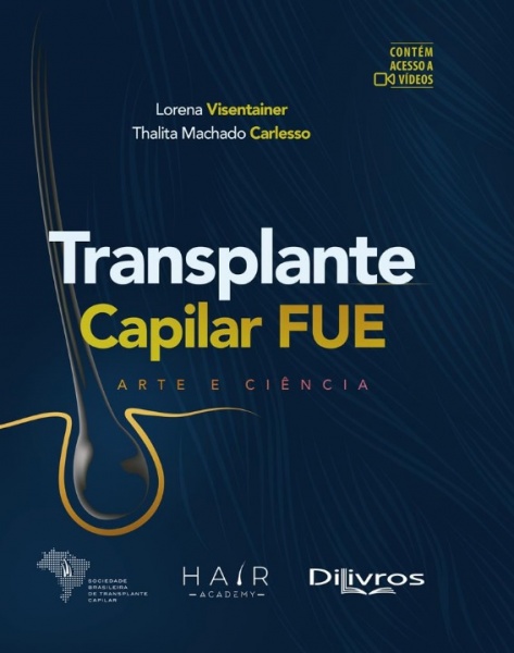 Transplante Capilar Fue