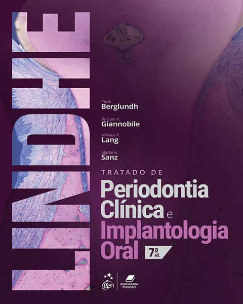 Tratado De Periodontia Clinica E Implantologia Oral