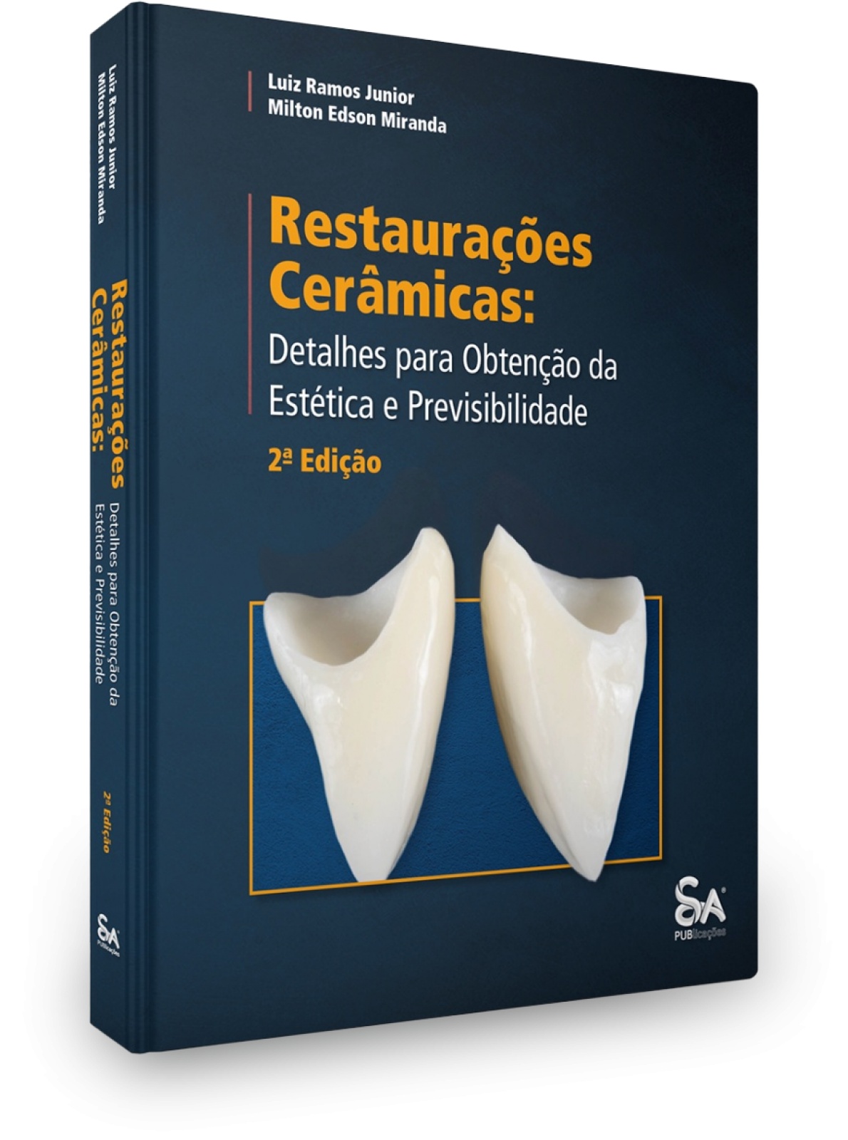 Restaurações Cerâmicas: Detalhes Para Obtenção Da Estética E Previsibilidade