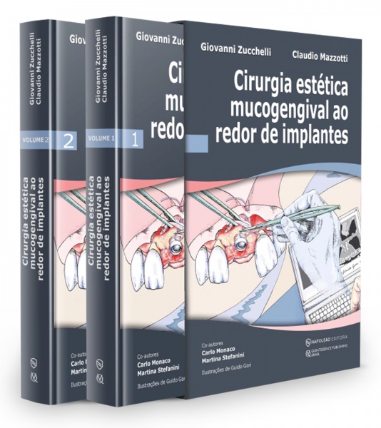 Cirurgia Estética Mucogengival Ao Redor De Implantes - Volume 1 E Volume 2 