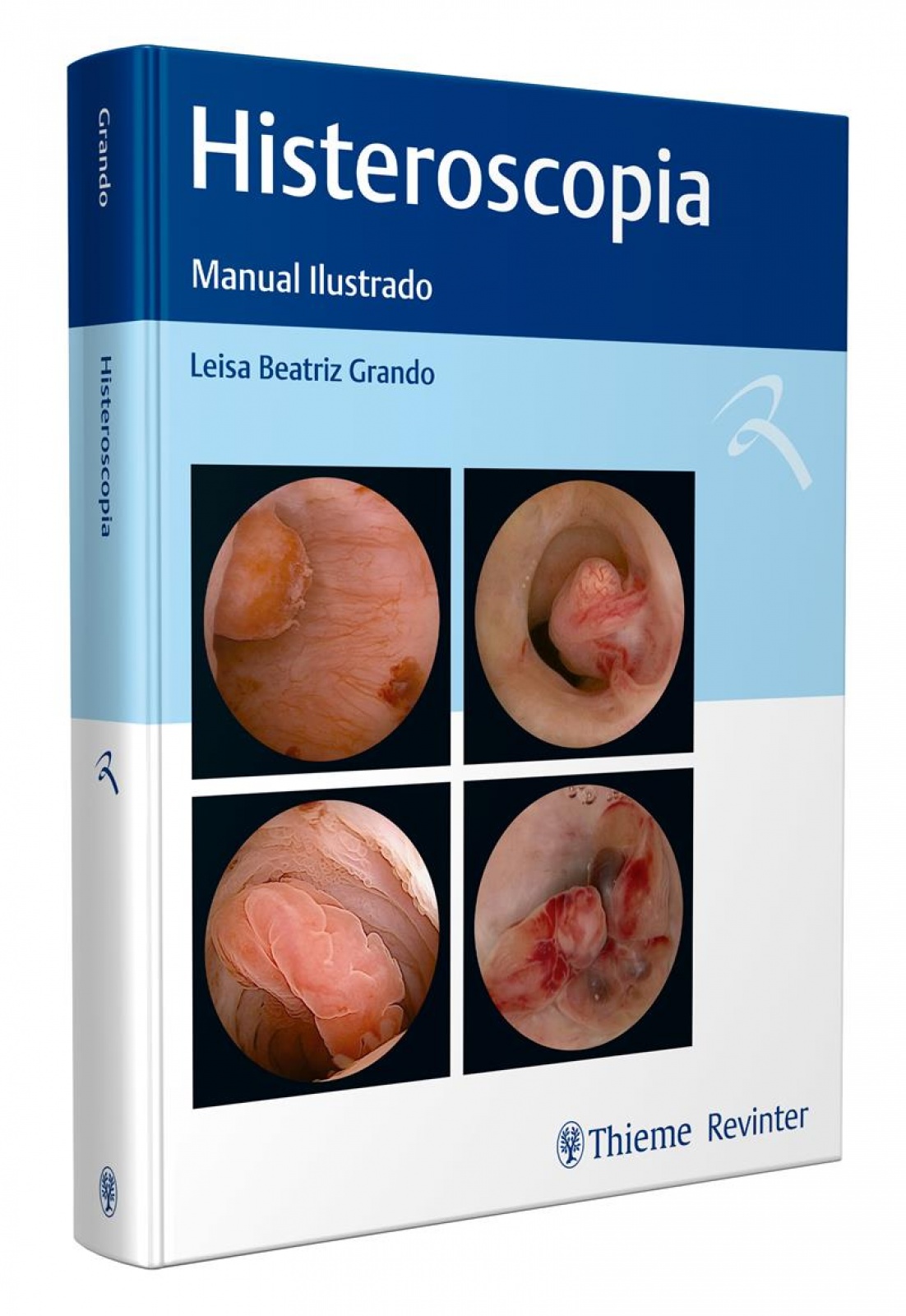 Histeroscopia: Manual Ilustrado.
