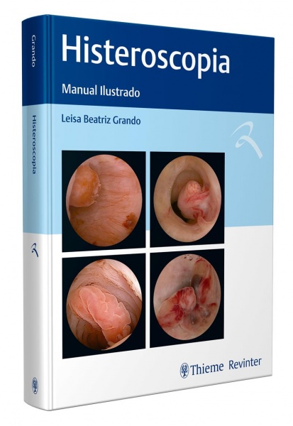 Histeroscopia: Manual Ilustrado.