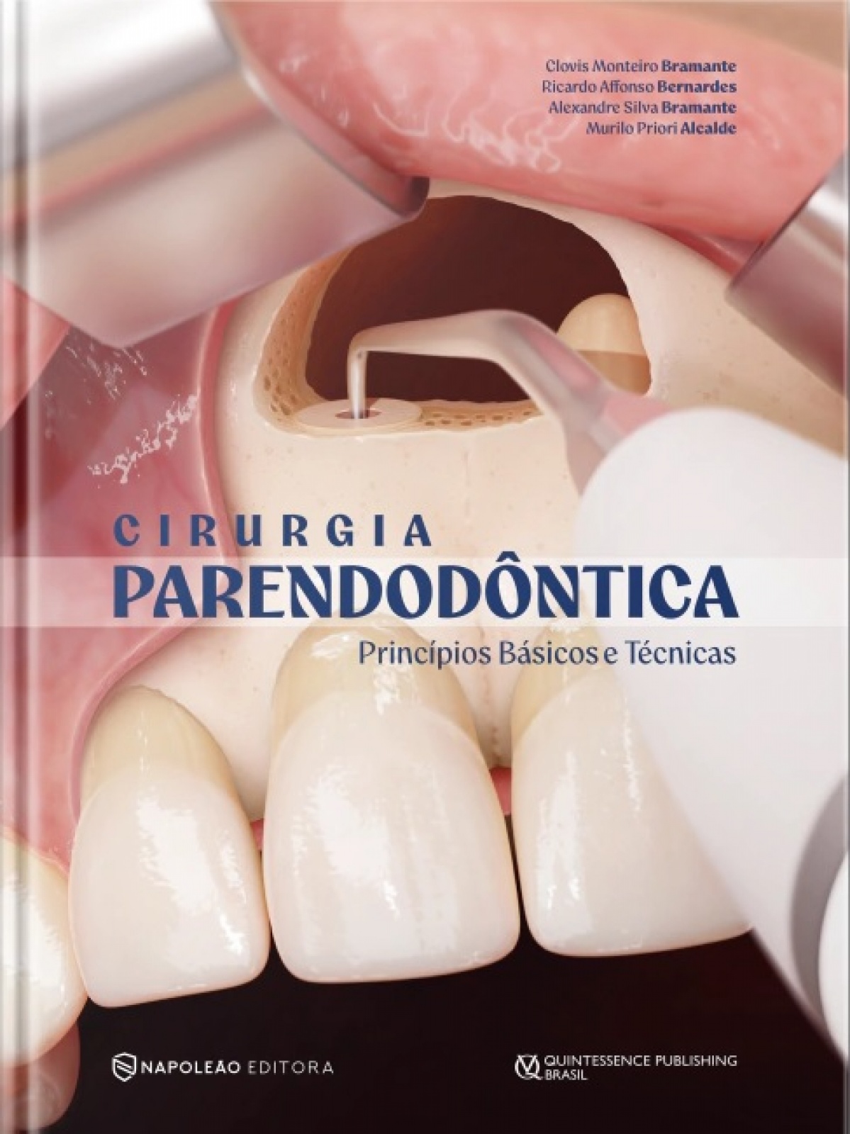 Cirurgia Parendodôntica - Princípios Básicos E Técnicas